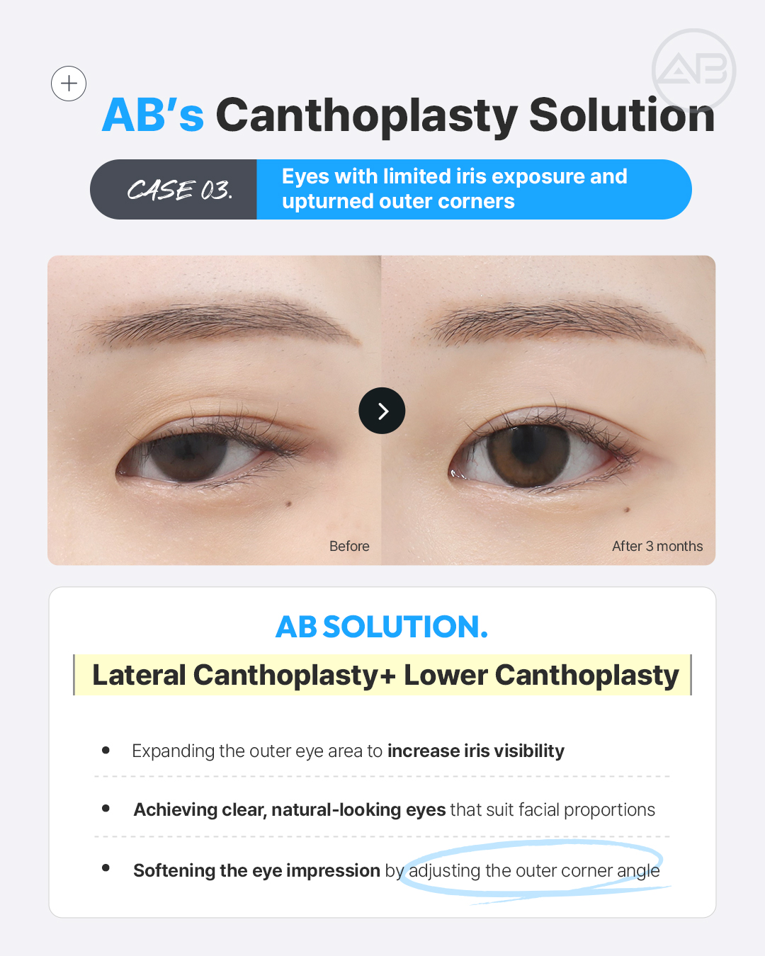 AB Plastic Surgery Hospital | Seoul