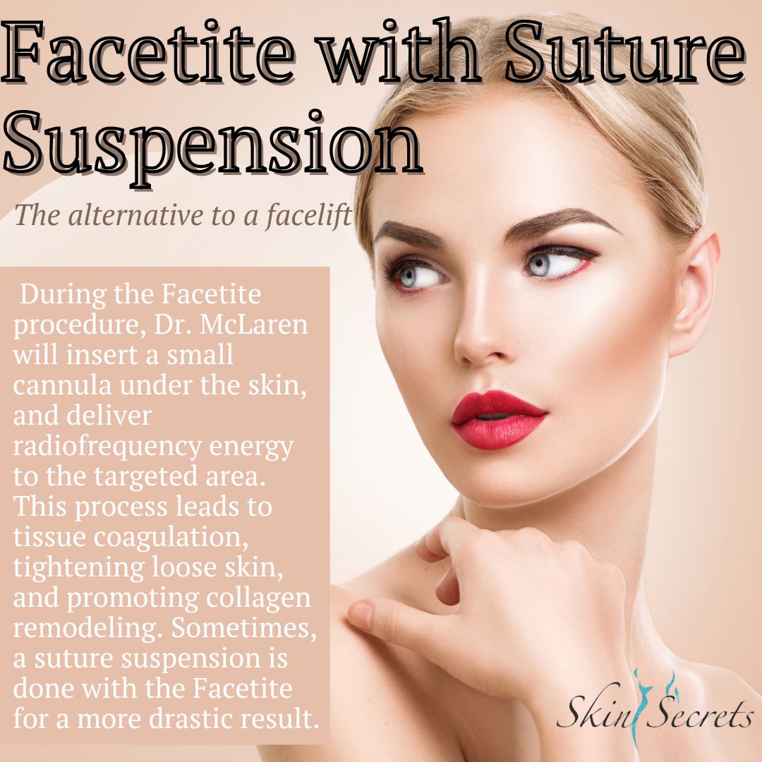 Streamlined 1-hour procedure.... - Skin Secrets SW Florida