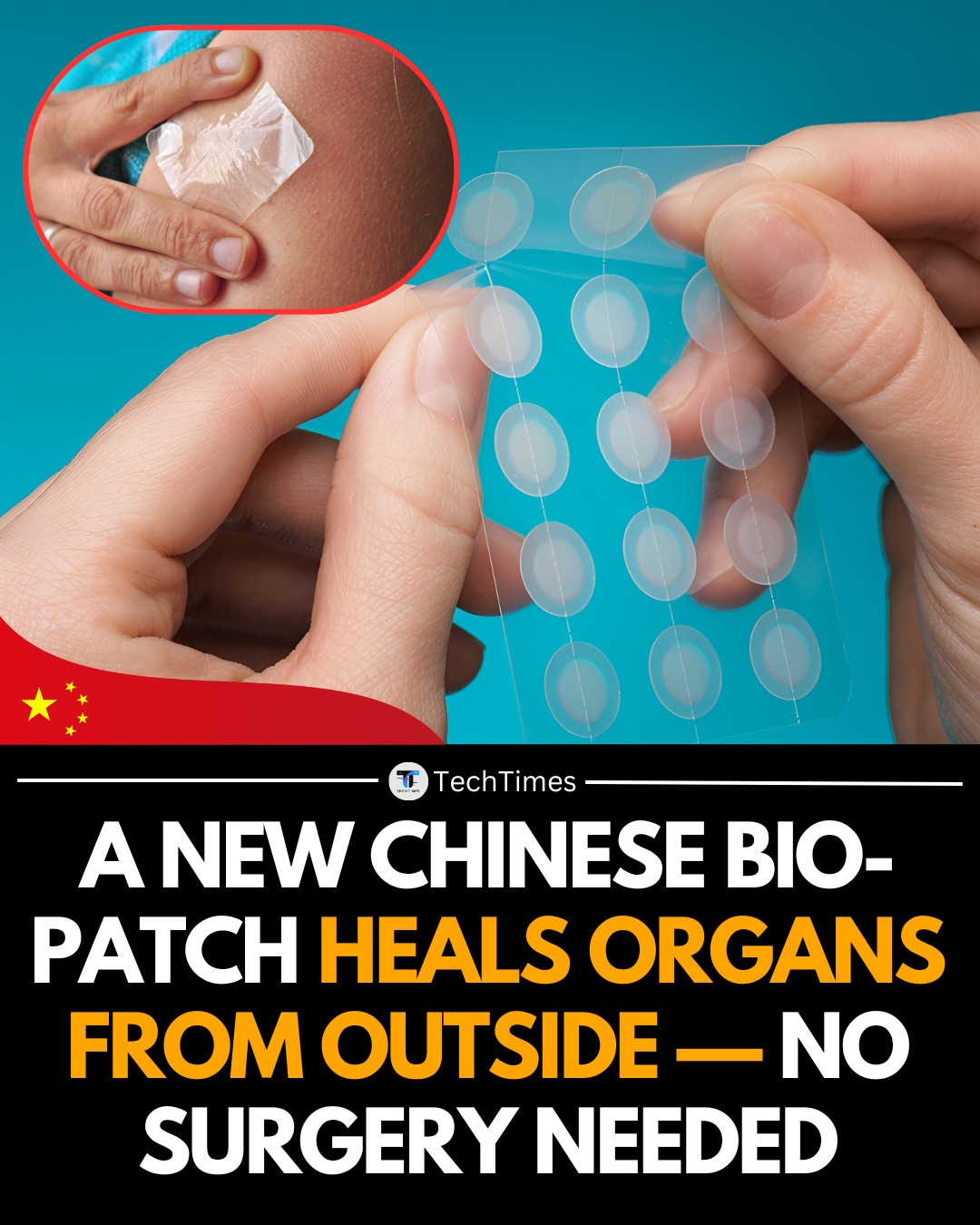 TechTimes - Chinese biomedical engineers have developed a ...