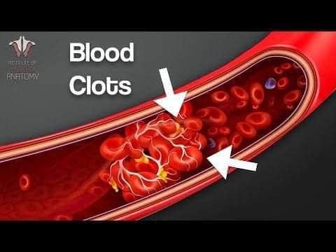 Blood clots are clumps of blood that... - FOHOW Clinic OGOJA