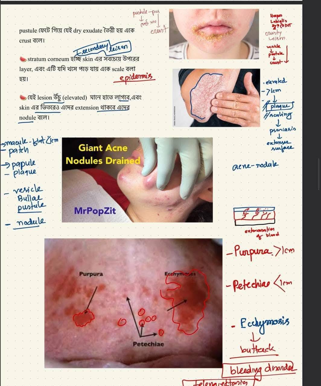 MediVerse - 🍀 Pathognomonic signs : 🍀 1. COPD -... | Facebook