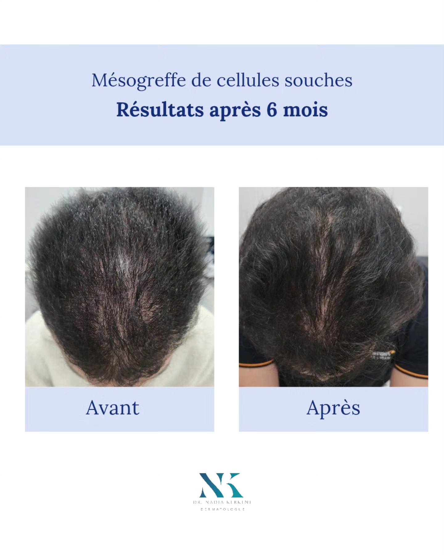 🌿 Dermatite atopique : comprendre pour... - Dr. Nadia Kerkeni | Facebook