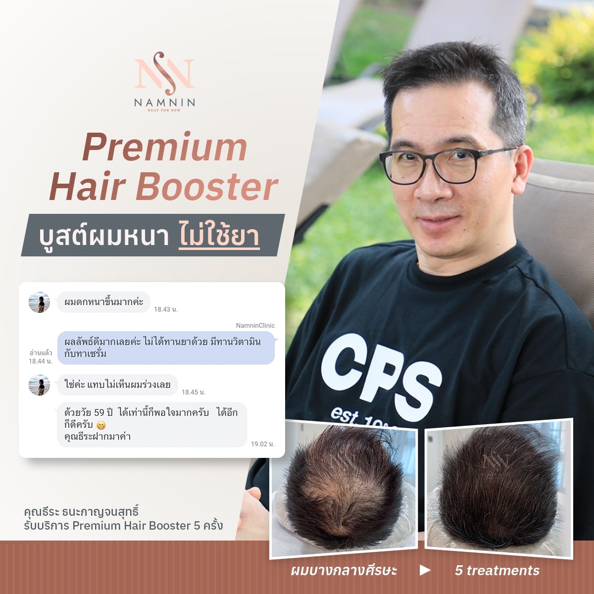 Namnin ForV clinic ปลูกผมถาวรเทคนิค NEAT โดยแพทย์ทุกกราฟ | Facebook