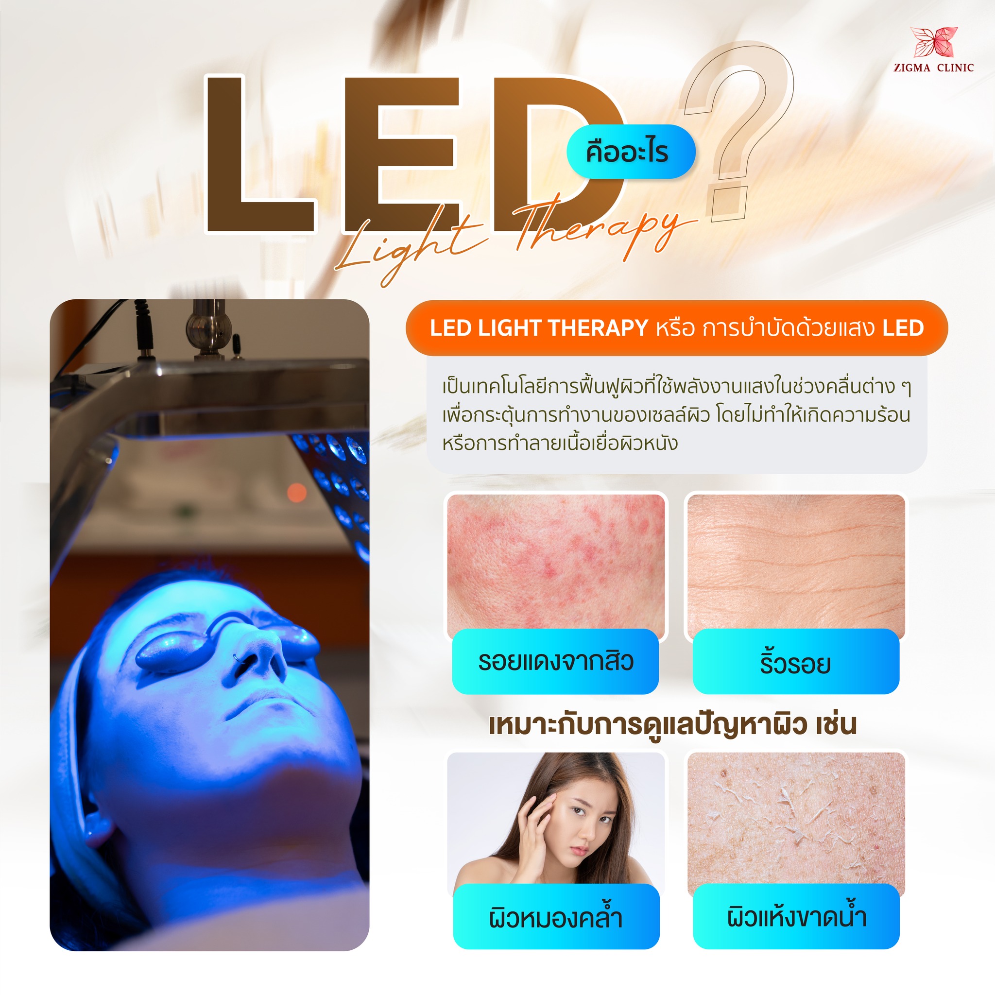 Zigma - LED Light Therapy คืออะไร อีกหนึ่งตัวช่วยดูแลผิวด้วยพลังงานแสง ...