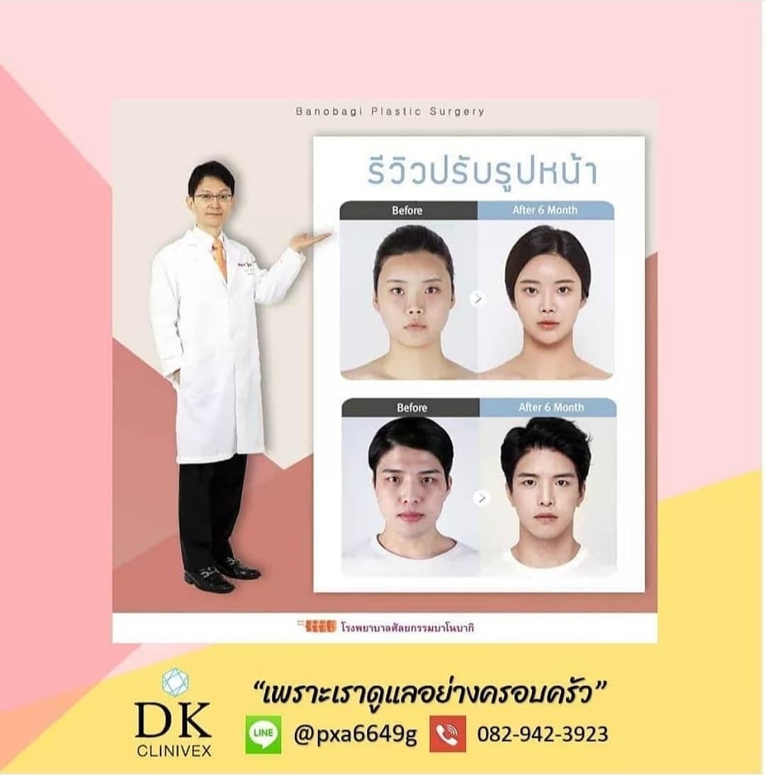Seoul.surgery - ศัลยกรรมปรับรูปหน้า... | Facebook