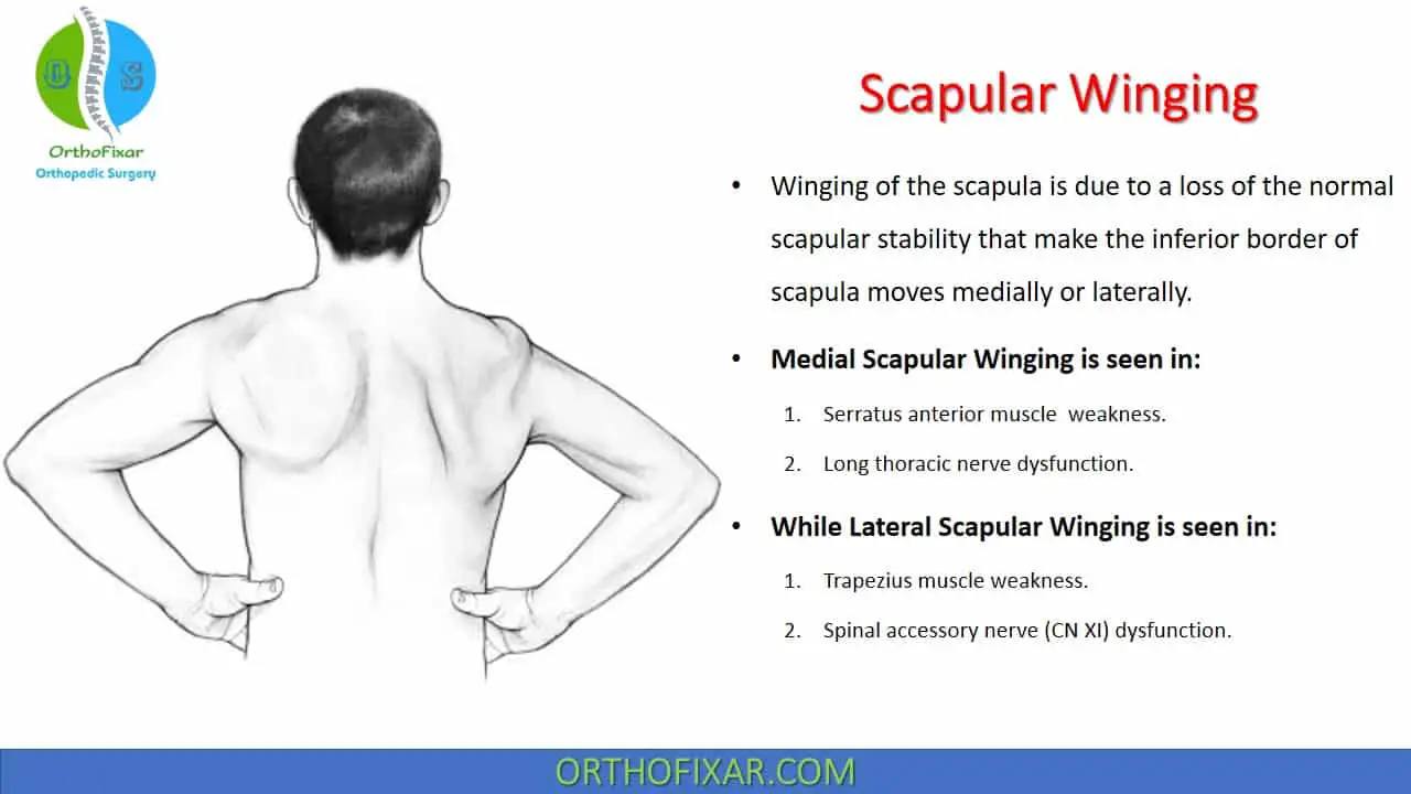 Scapular Winging Test -... - OrthoFixar - Orthopedic Surgery