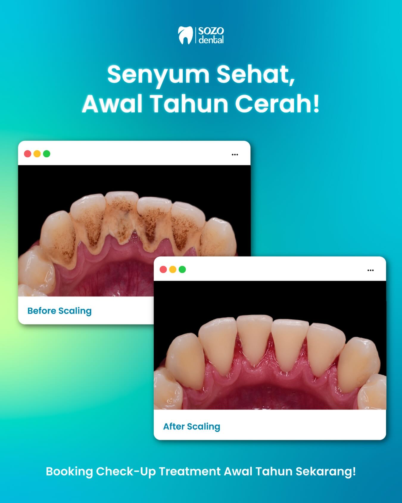 Sozo Dental Clinic | Facebook