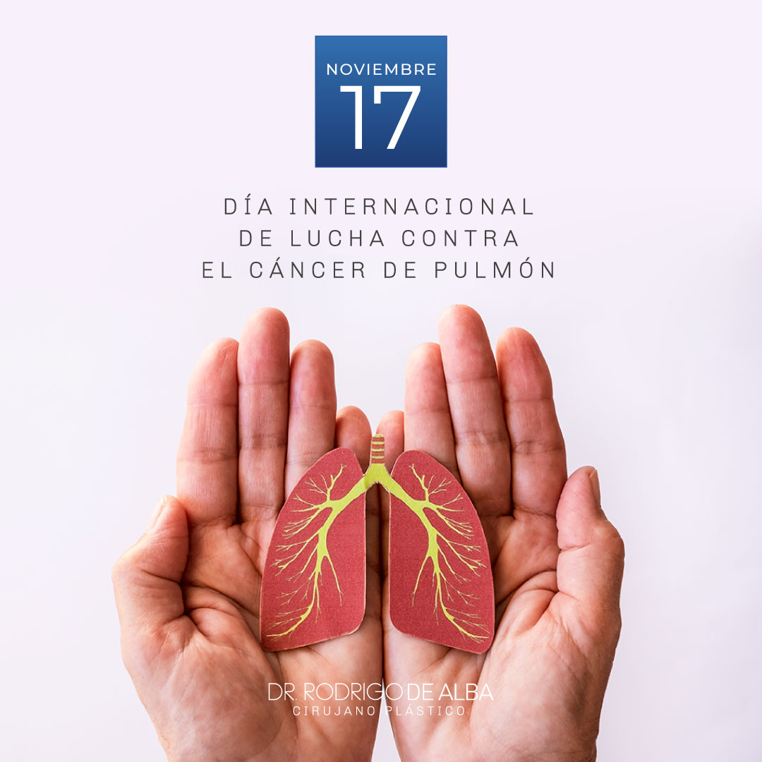 El cáncer del pulmón es una... - Dr. Rodrigo de Alba Ritz | Facebook