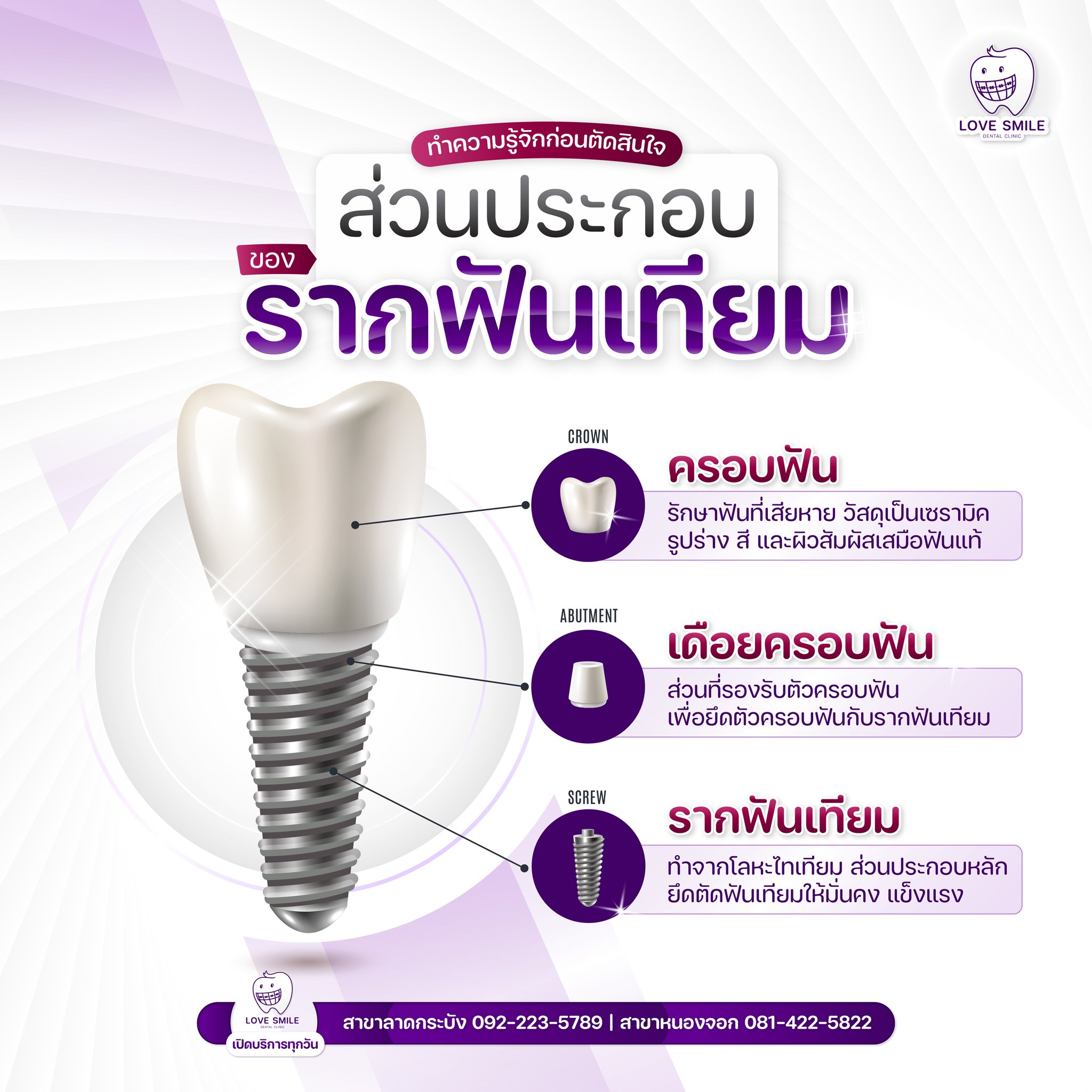 💓 ทำความรู้จักก่อนตัดสินใจ รากฟันเทียม ประกอบด้สนส่วนใดบ้าง ครอบฟัน ...