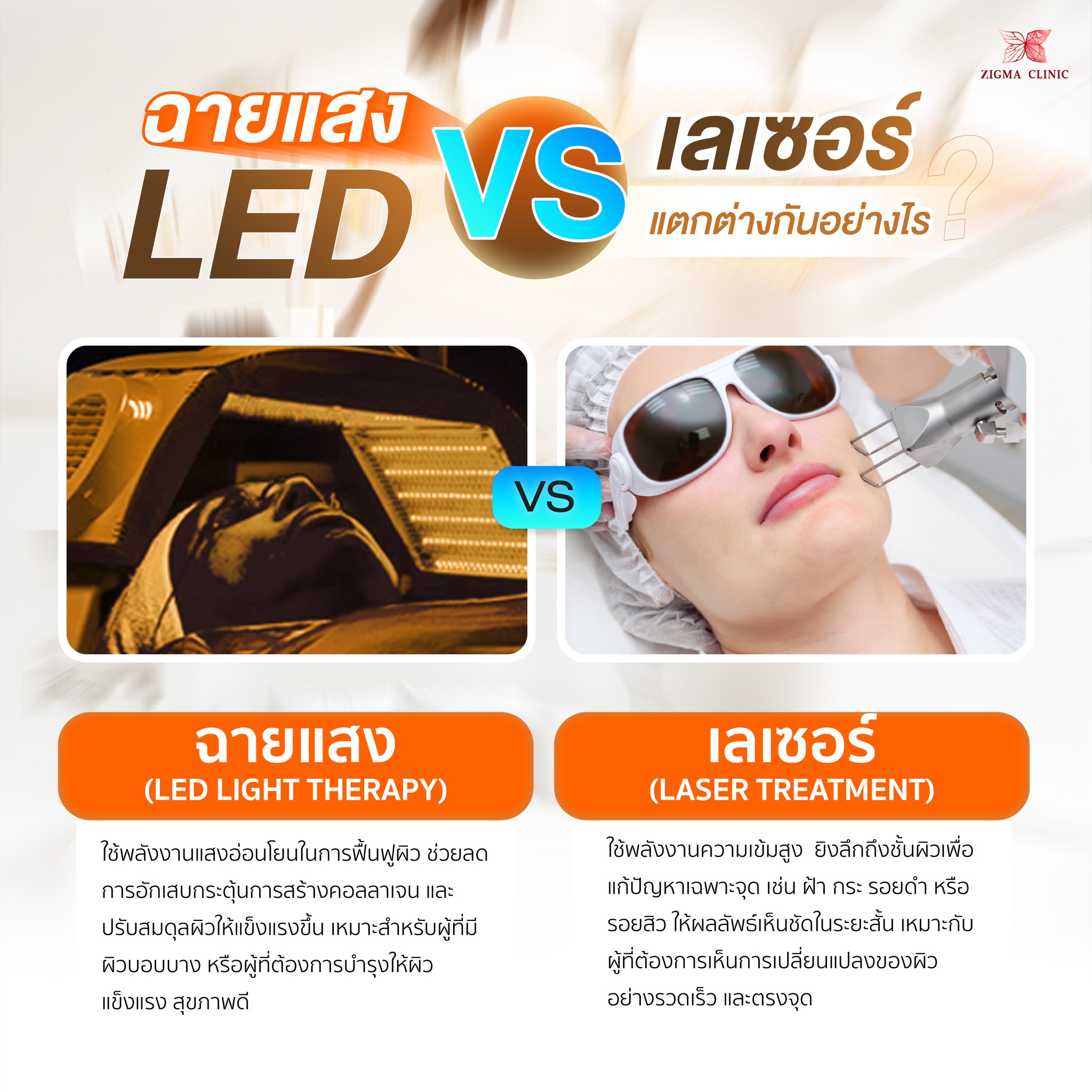 Zigma - 💡 ฉายแสง LED vs เลเซอร์ ต่างกันอย่างไร? เลือกให้ใช่กับปัญหาผิว ...