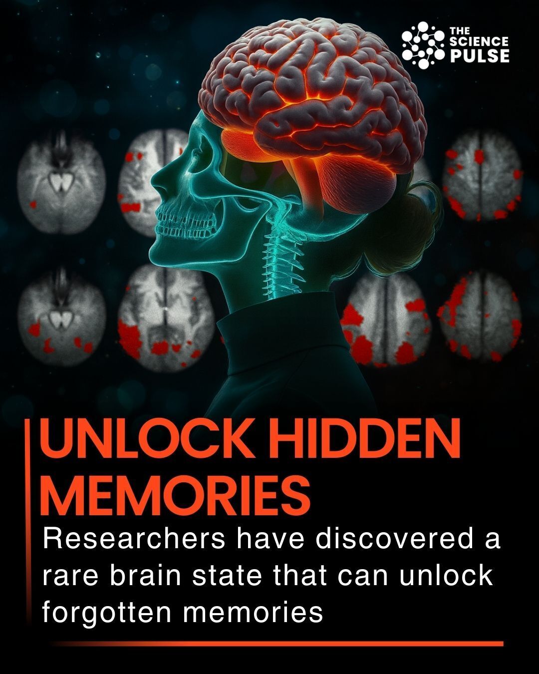 The Science - Scientists have uncovered a rare brain state that can ...