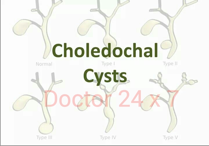 Choledochal Cyst & Anomalous Pancreatobiliary Junction - APBJ