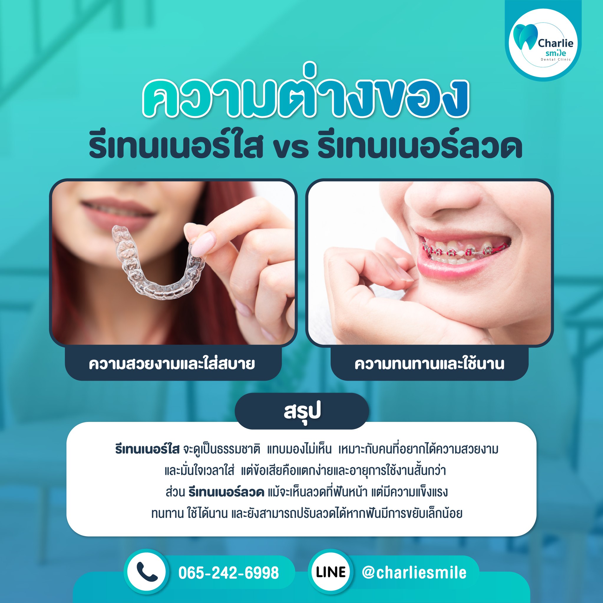 ถอดเหล็กแล้วต้องใส่ “รีเทนเนอร์” แต่เลือกแบบไหนดี? 🤔 🦷 รีเทนเนอร์ใส ใส่ ...