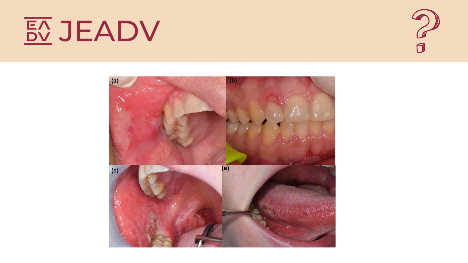 JEADV - Journal of the European Academy of Dermatology and Venereology