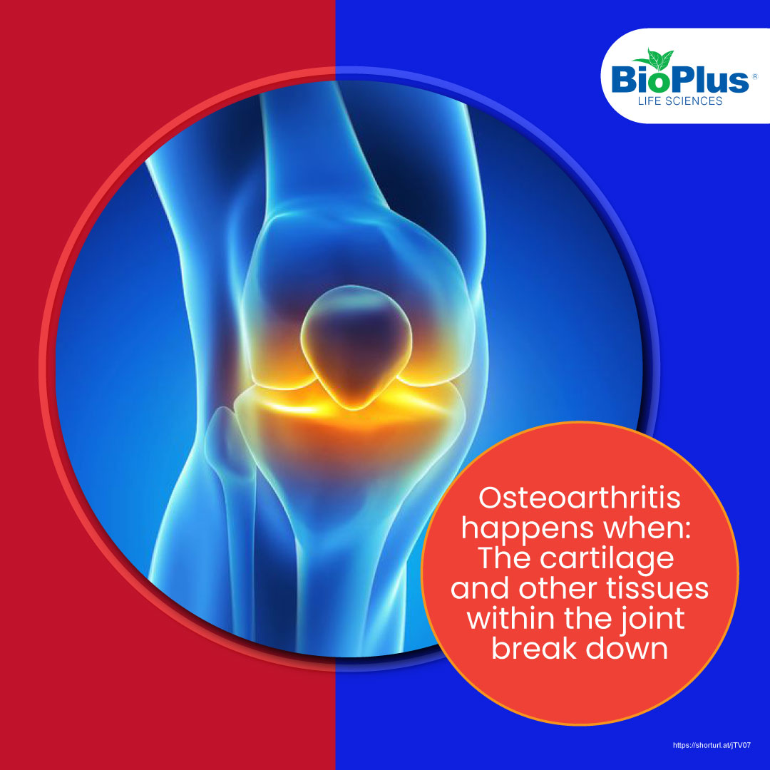 The Why Behind Osteoarthritis 🔍... - Bioplus Life Sciences | Facebook