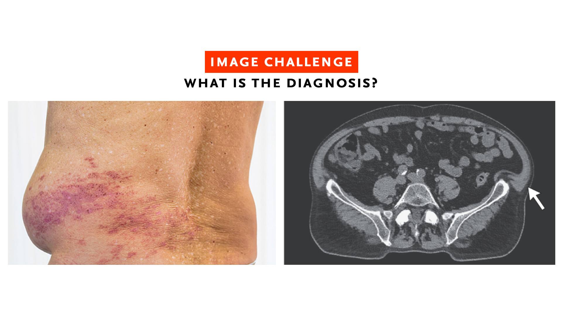 A 78-year-old man... - The New England Journal of Medicine | Facebook