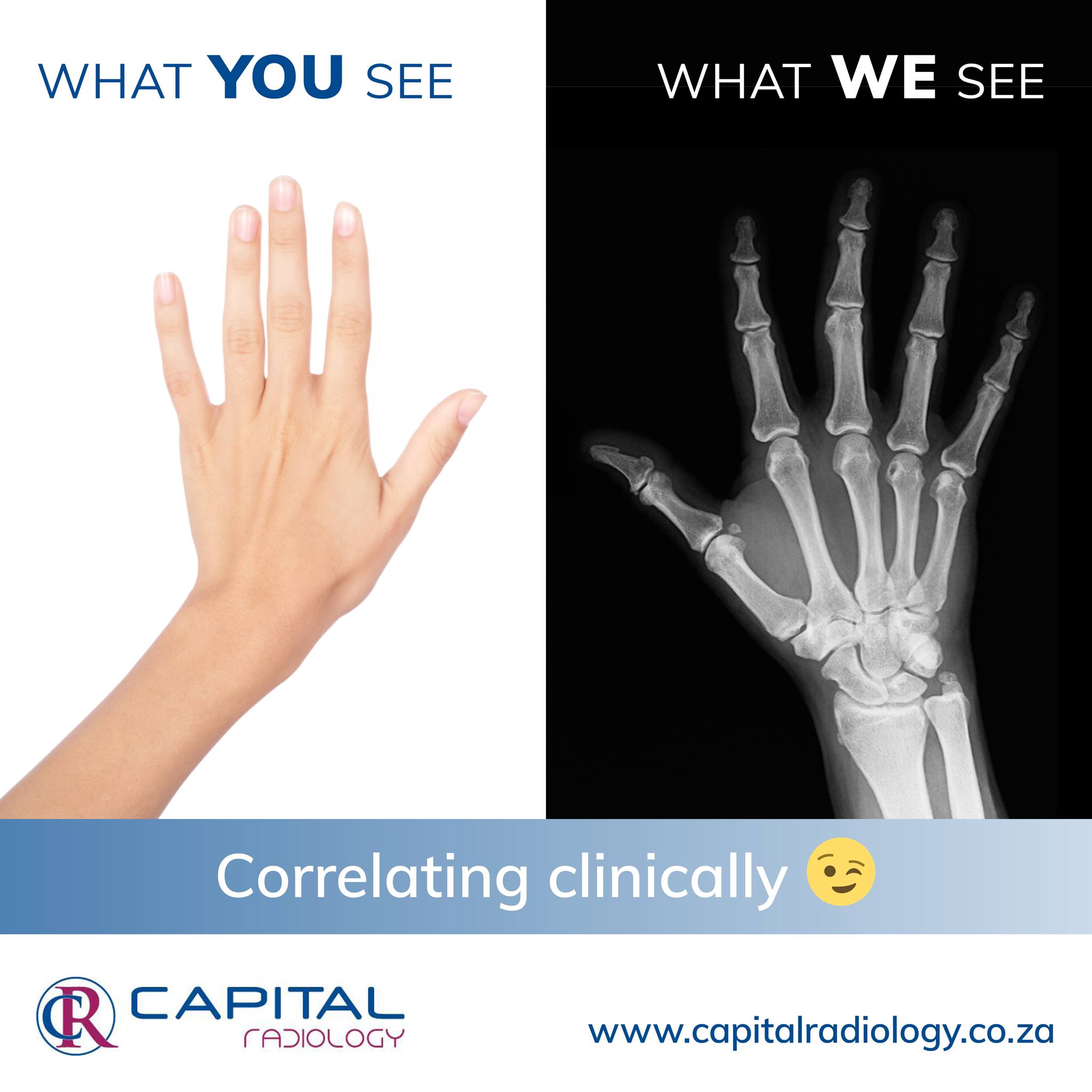 What You See vs What We See Accurate... - Capital Radiology