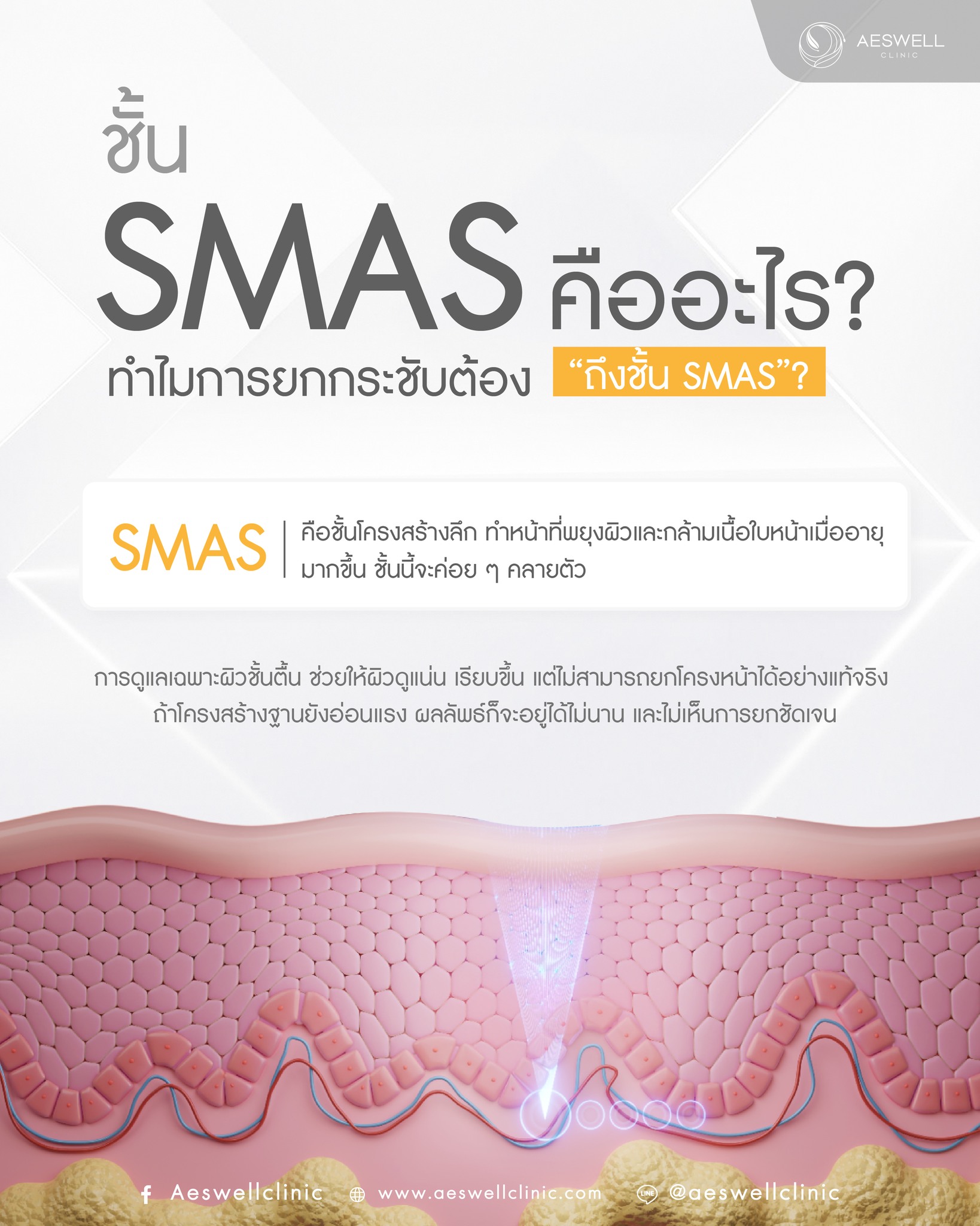 Aeswell - ชั้น SMAS คืออะไร? ทำไมการยกกระชับต้อง “ถึงชั้น SMAS”? SMAS ...