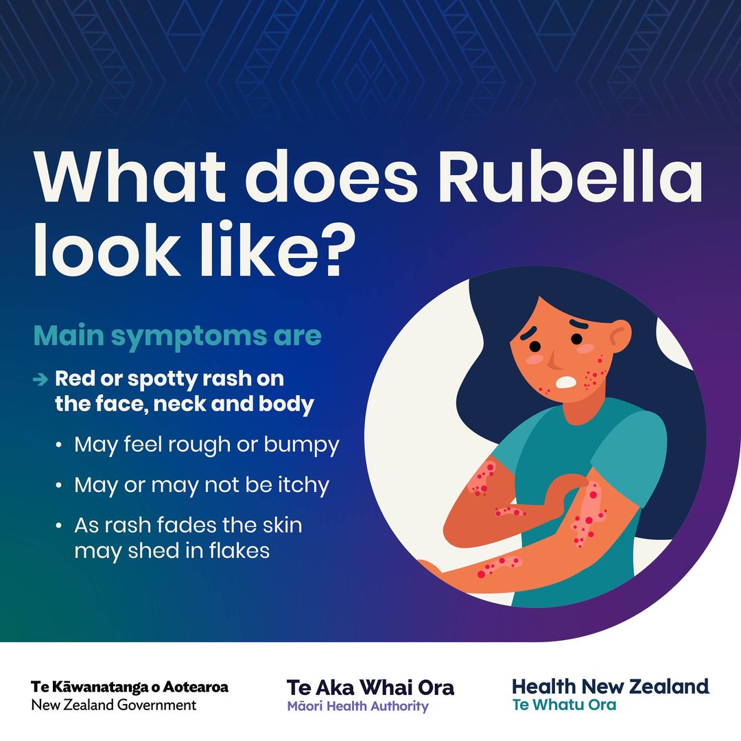 Rubella (German measles) is a... - Feilding Health Care