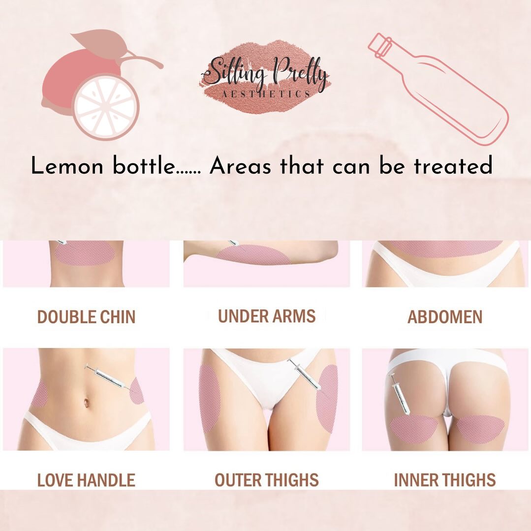 Lemon bottle 🍋🍋🍋 areas that can be treated….. If you have stubborn fat pockets and unsure if you can have this treatment book a FREE consultation # lemonbottlefatdissolving #lemonbottle #lemonbottlelipolysis #lipsandchin #combo #russianlips #