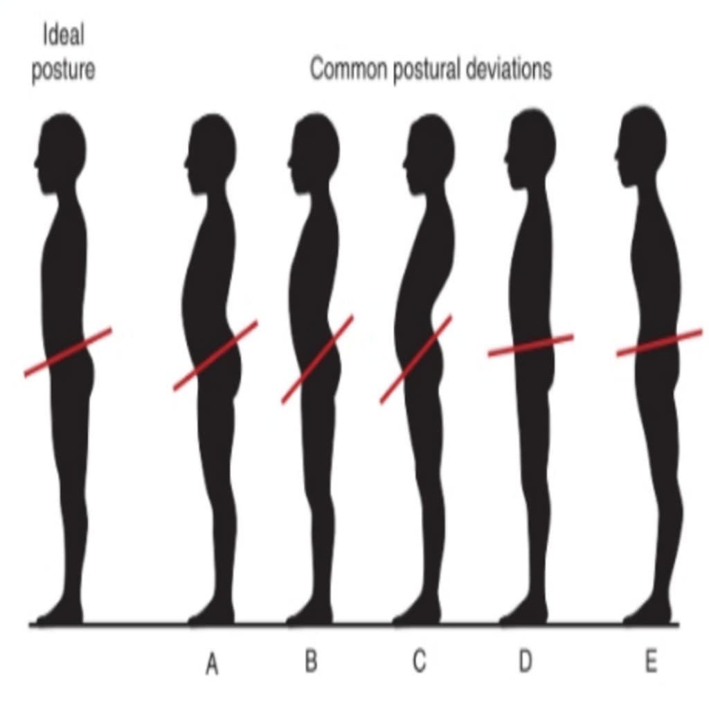 Ozari's Kinesiotherapy Clinic - ‼️SAGITTAL POSTURAL ALIGNMENT‼️ The ...