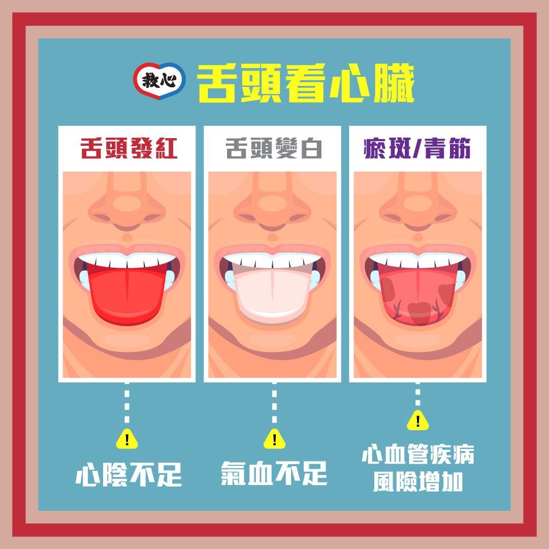 救心Kyushin - 【👅舌頭看心臟😍】...
