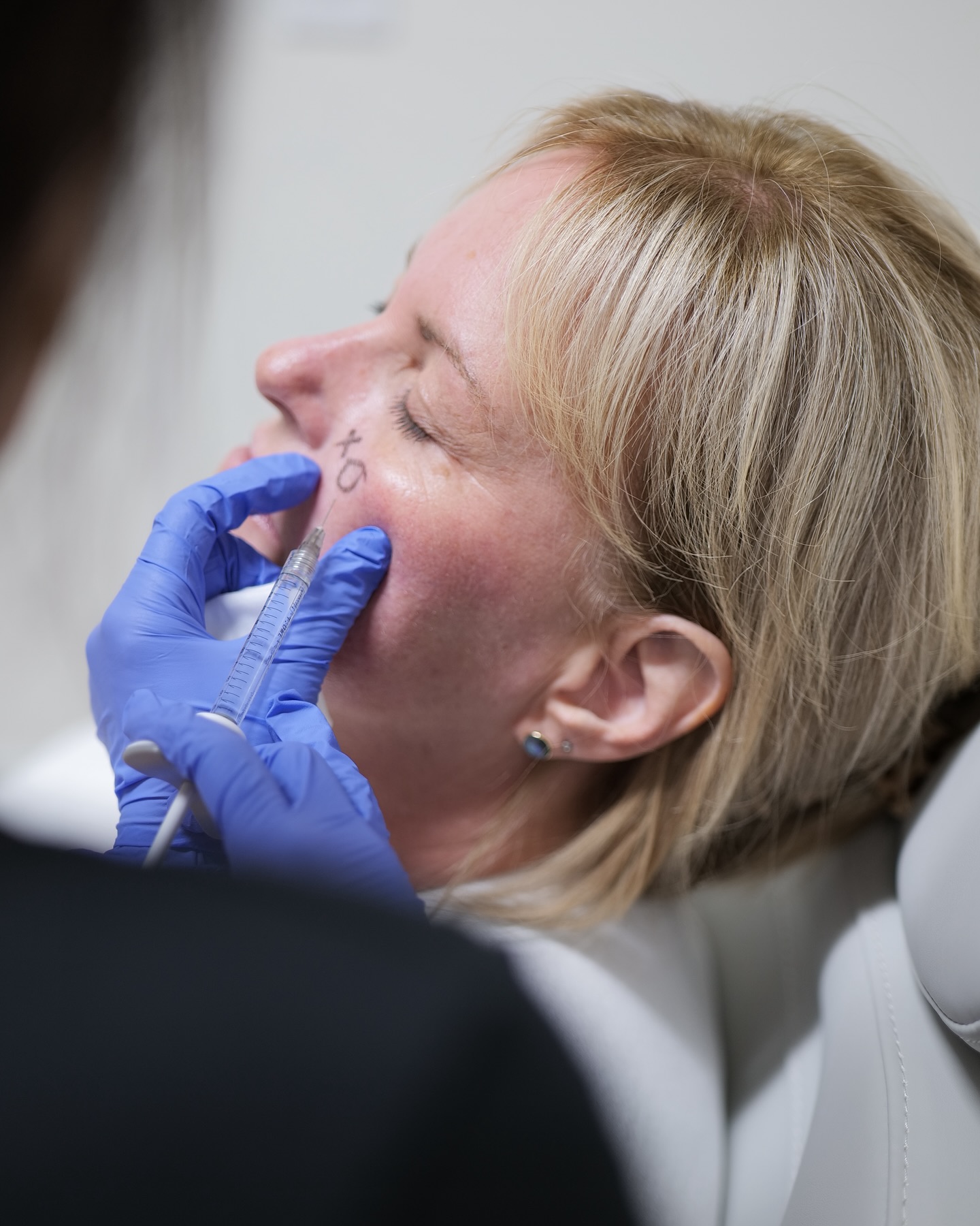 Richard - Let’s talk about marking up our patients before injection! 💉 ...