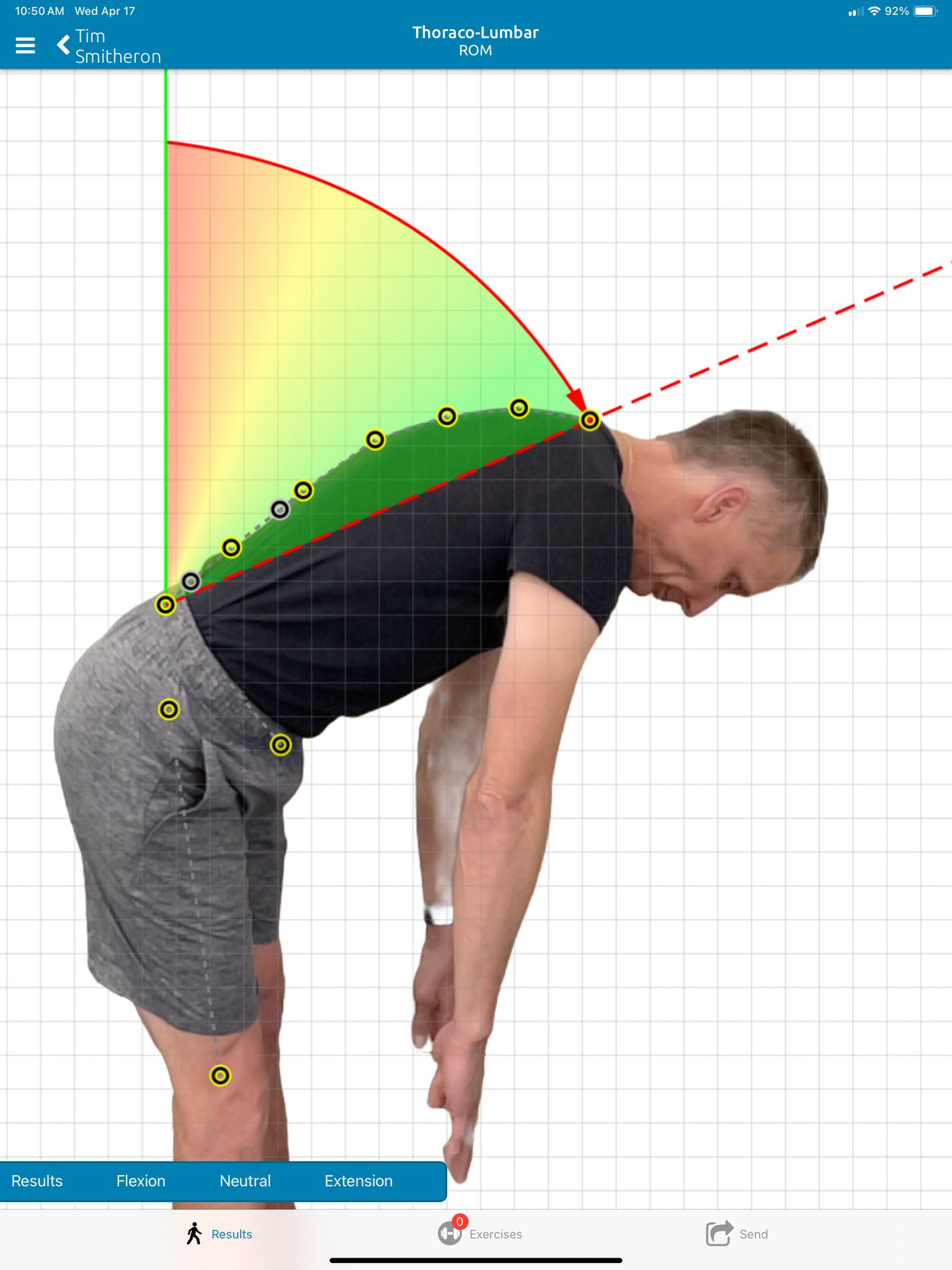 PostureScreen has updated to include... - Posture Analysis