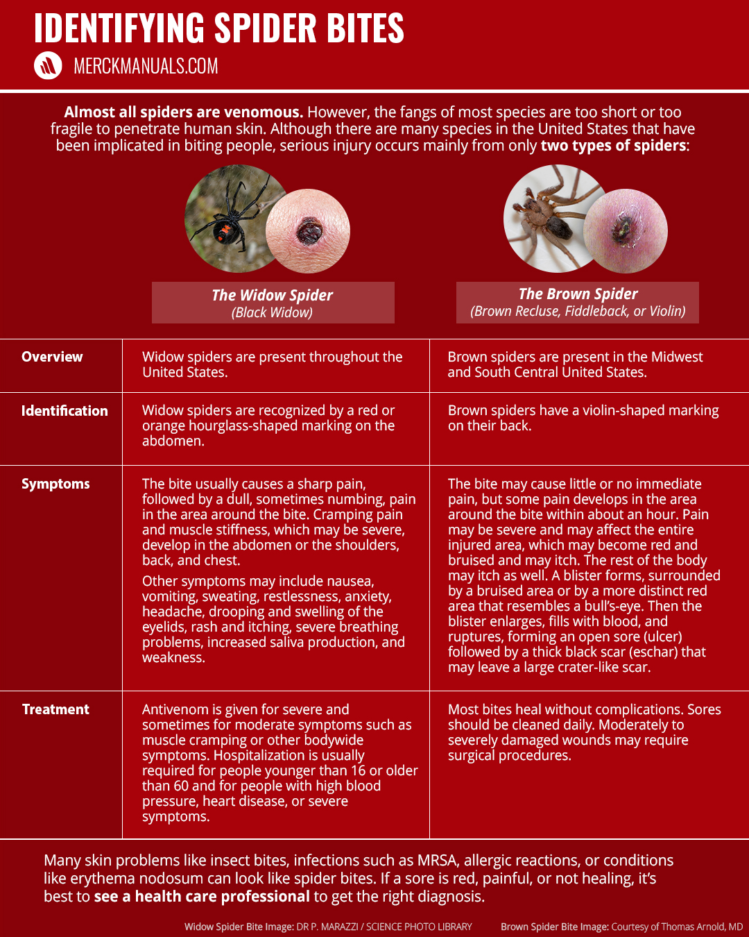 Merck - Identifying a particular spider on the basis of its bite mark ...