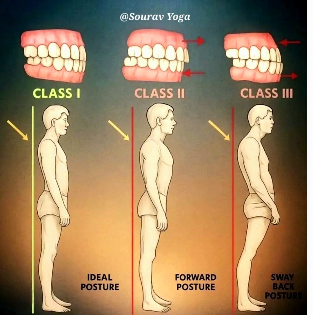 Sourav Yoga - Body Posture Correction ️ Sourav Yoga... | Facebook
