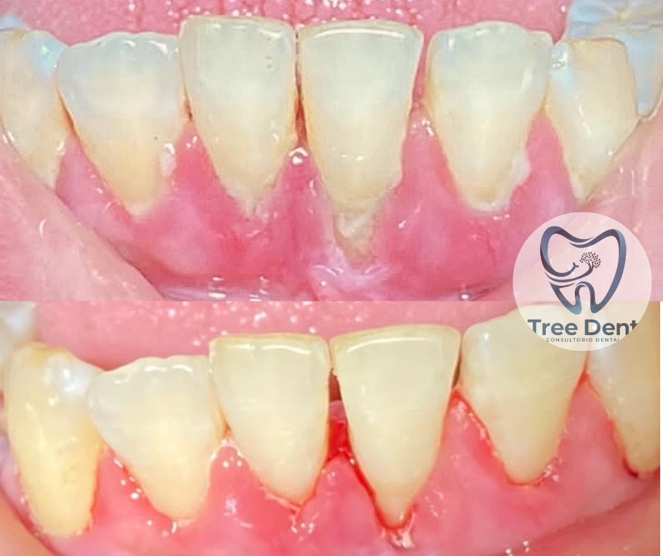 Tree Dent Consultorio Dental | Tuxtla Gutiérrez