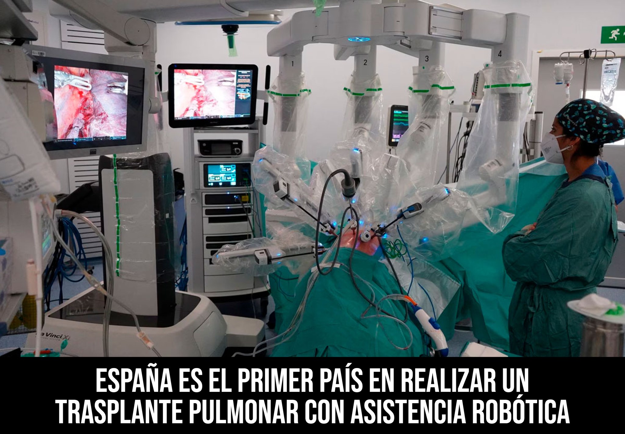 Phillip - España es el primer país en realizar una cirugía robótica de ...