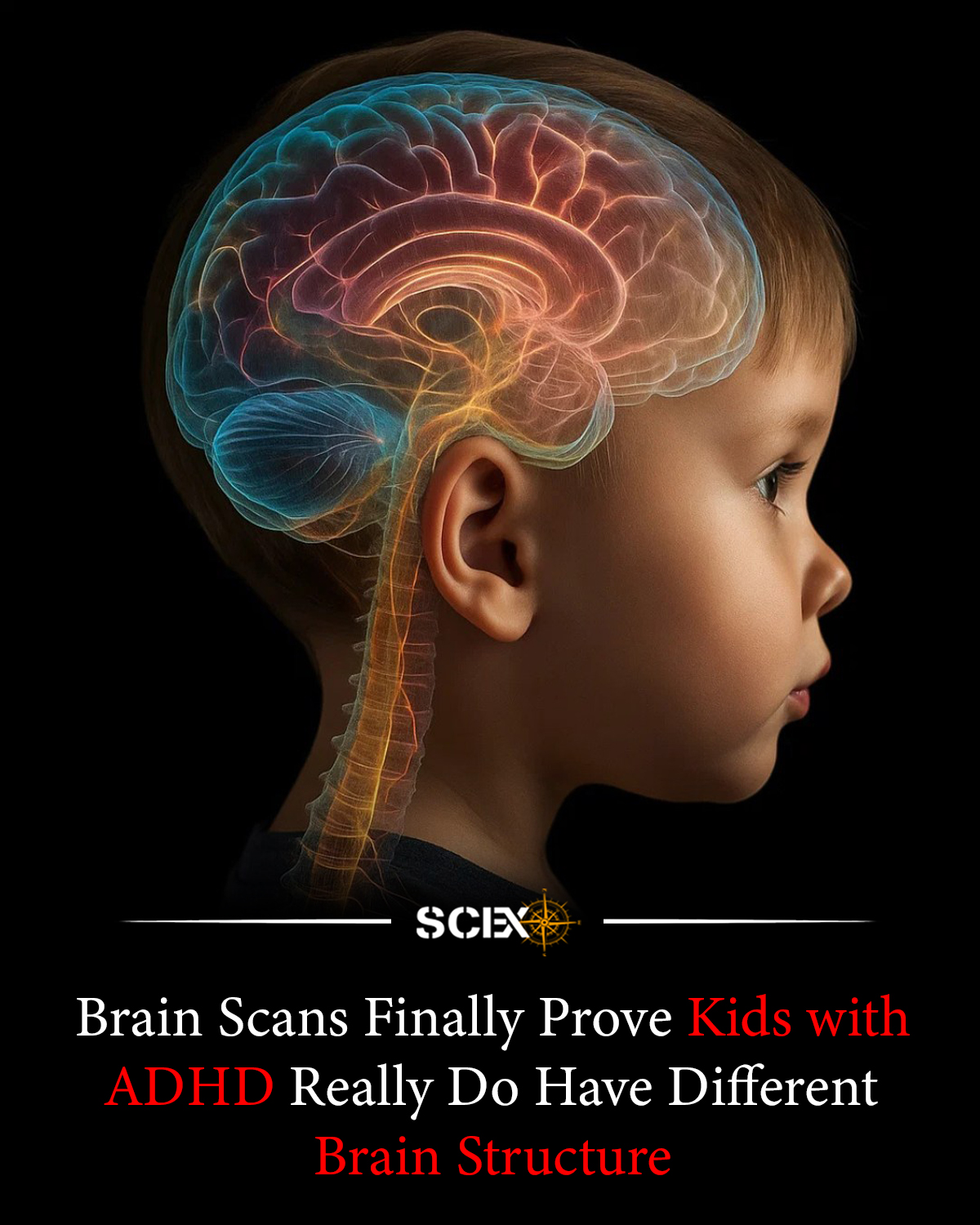 Science - 🧠 People with ADHD really do have different brains — and now ...