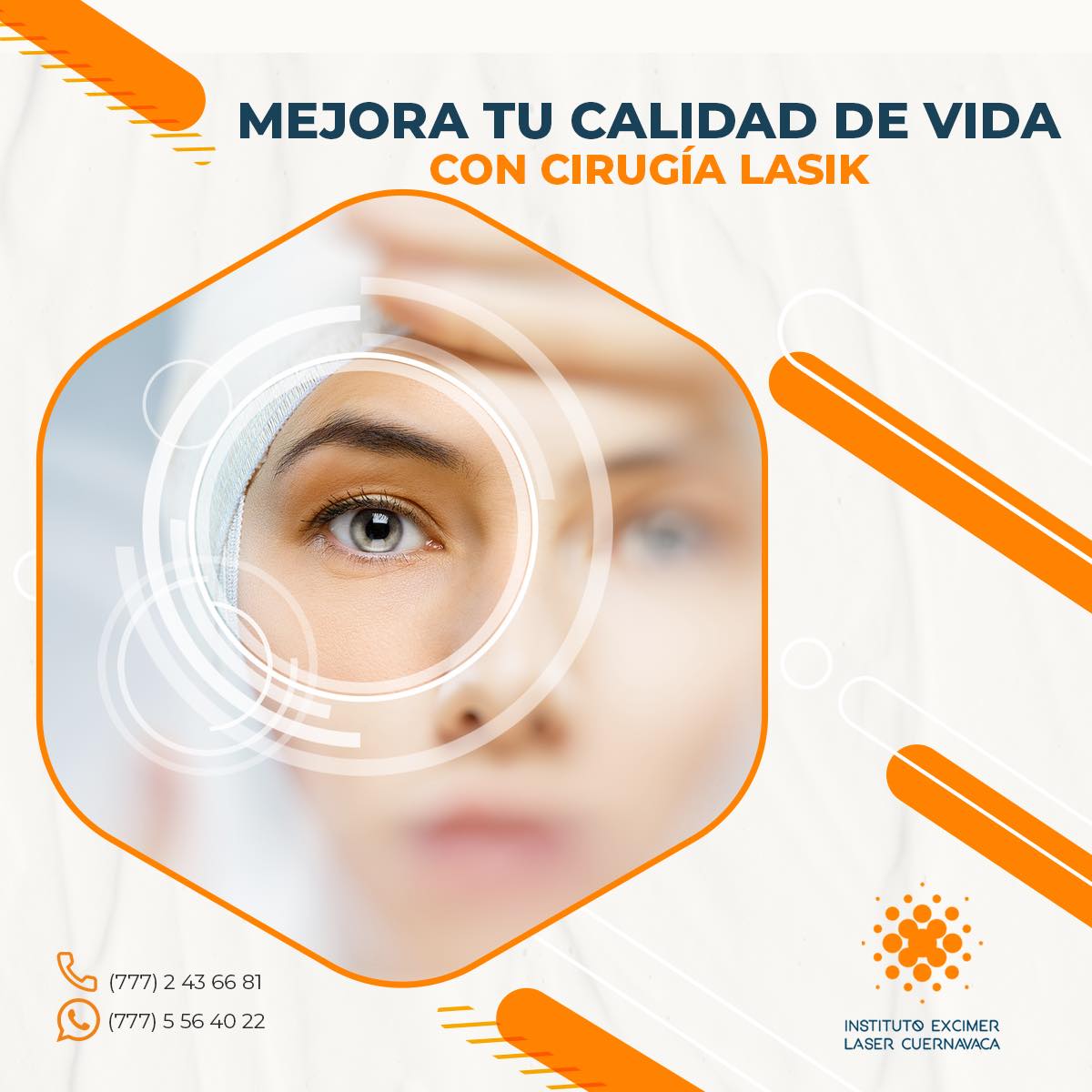 Realizamos la cirugía... - Instituto Excimer Láser Cuernavaca | Facebook