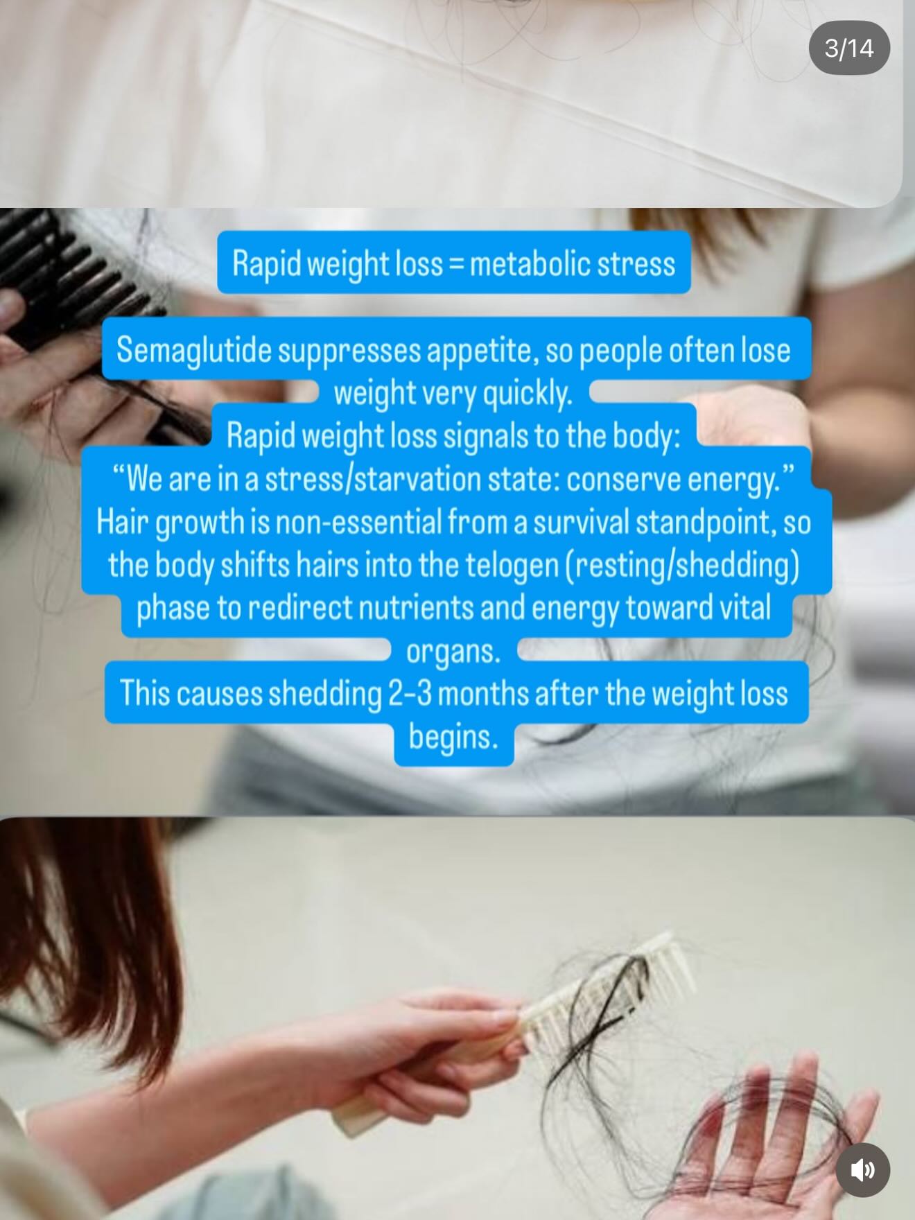 Semaglutide + Hair Loss — let's talk about it. If you've noticed increased shedding while on semaglutide, you're not imagining it — and you're not alone. Hair loss associated with semaglutide is