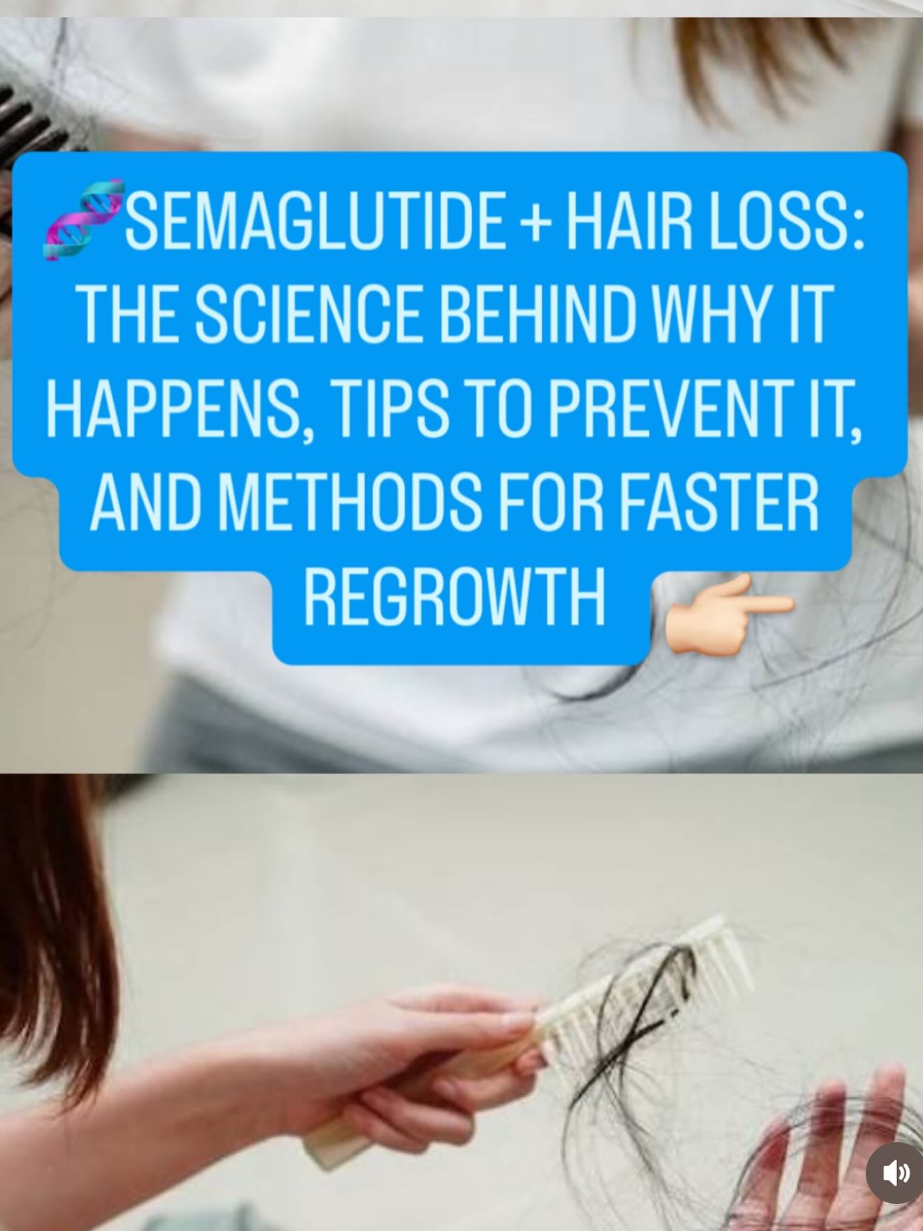 Semaglutide + Hair Loss — let's talk about it. If you've noticed increased shedding while on semaglutide, you're not imagining it — and you're not alone. Hair loss associated with semaglutide is