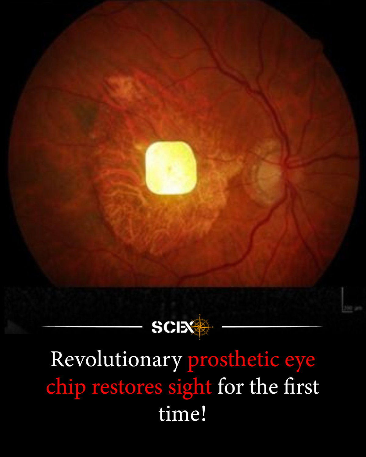 Science - 👁️ For the first time, scientists have restored central ...