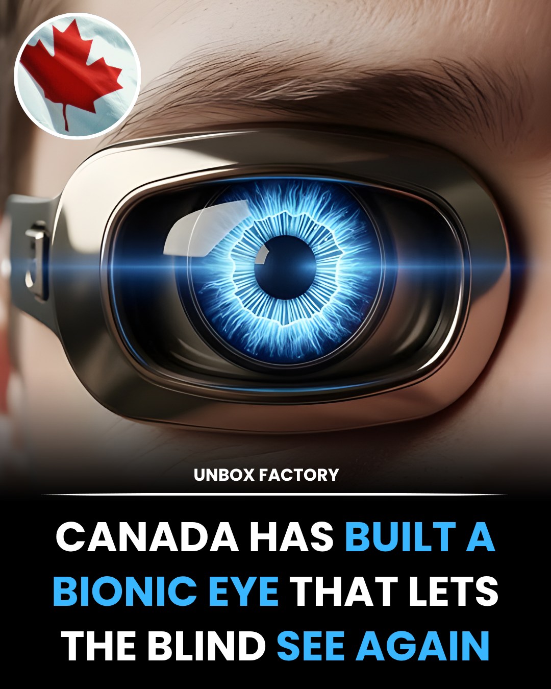 Unbox - Canadian scientists have developed a bionic eye implant that ...