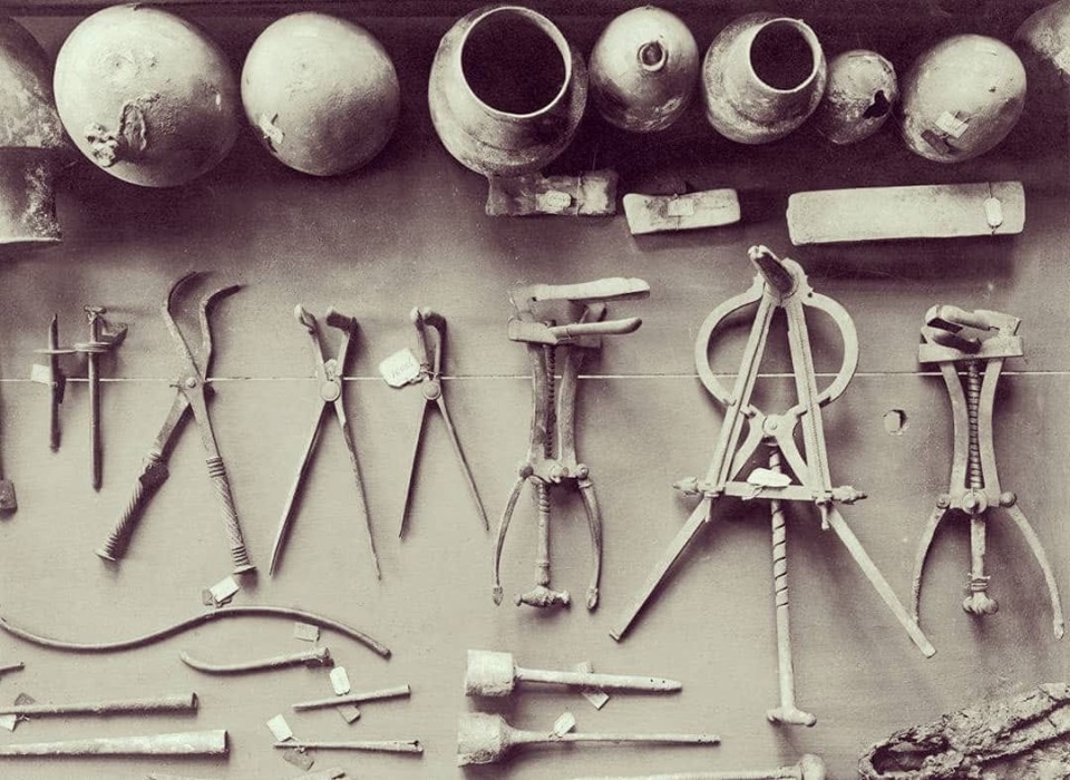 Traces of History and Archeology and Art - 2,000-year-old medical ...