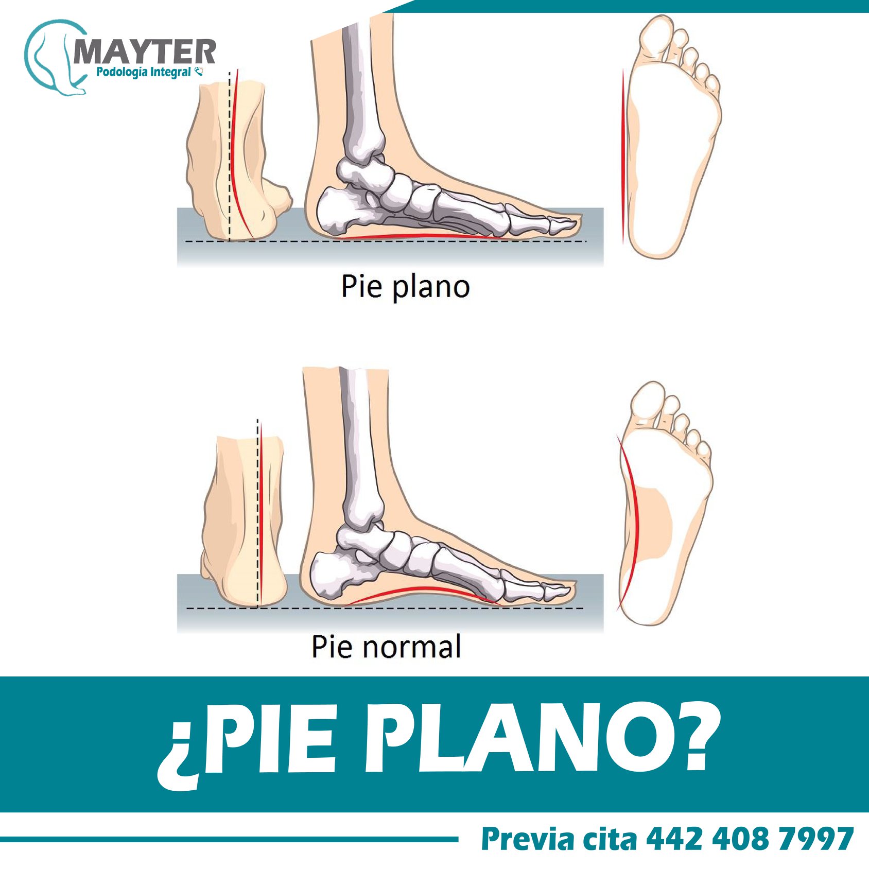 El pie... - Podologia Integral Mayter Enfermera y Podologa | Facebook