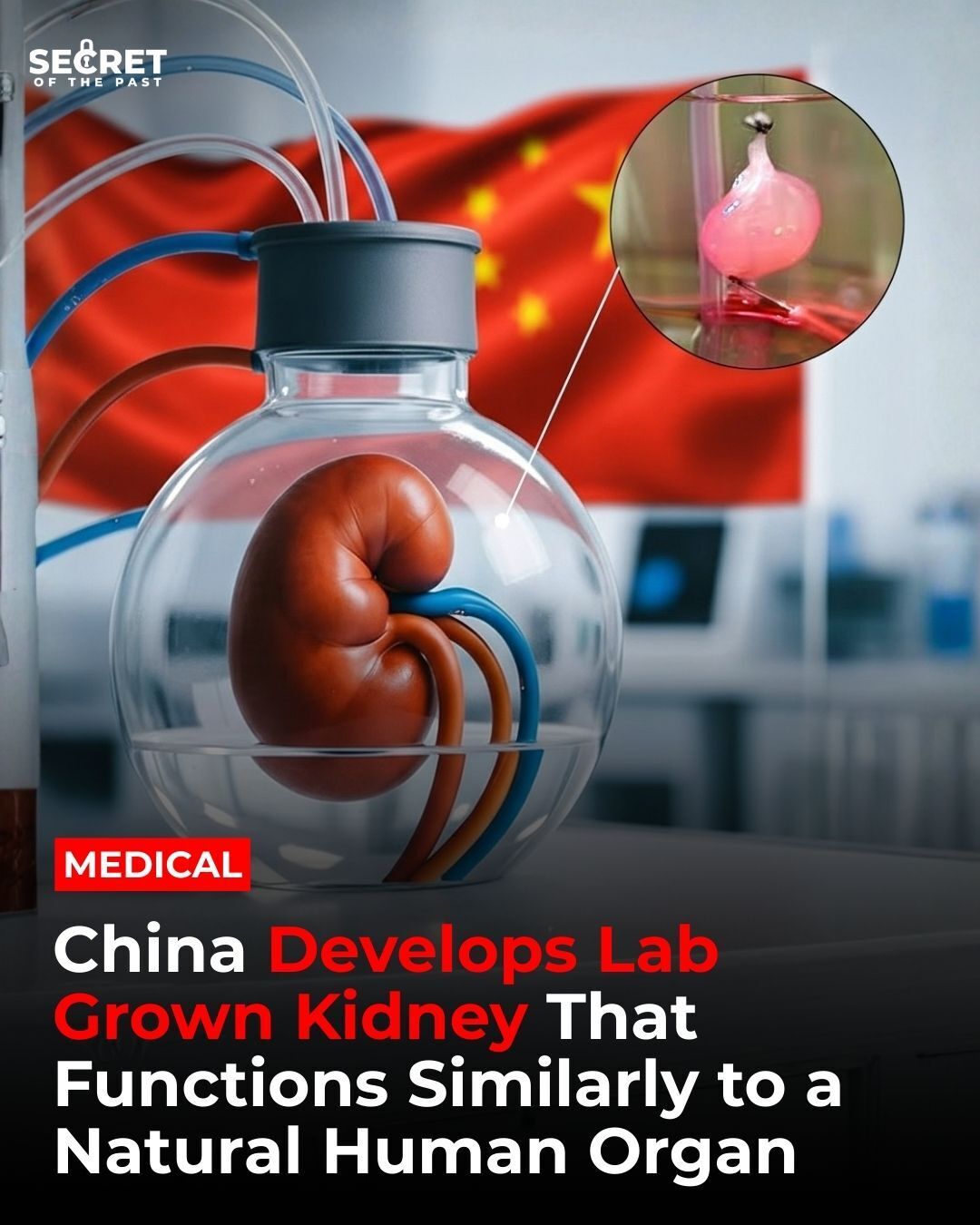 Secrets - Scientists in China have made a groundbreaking advancement in ...