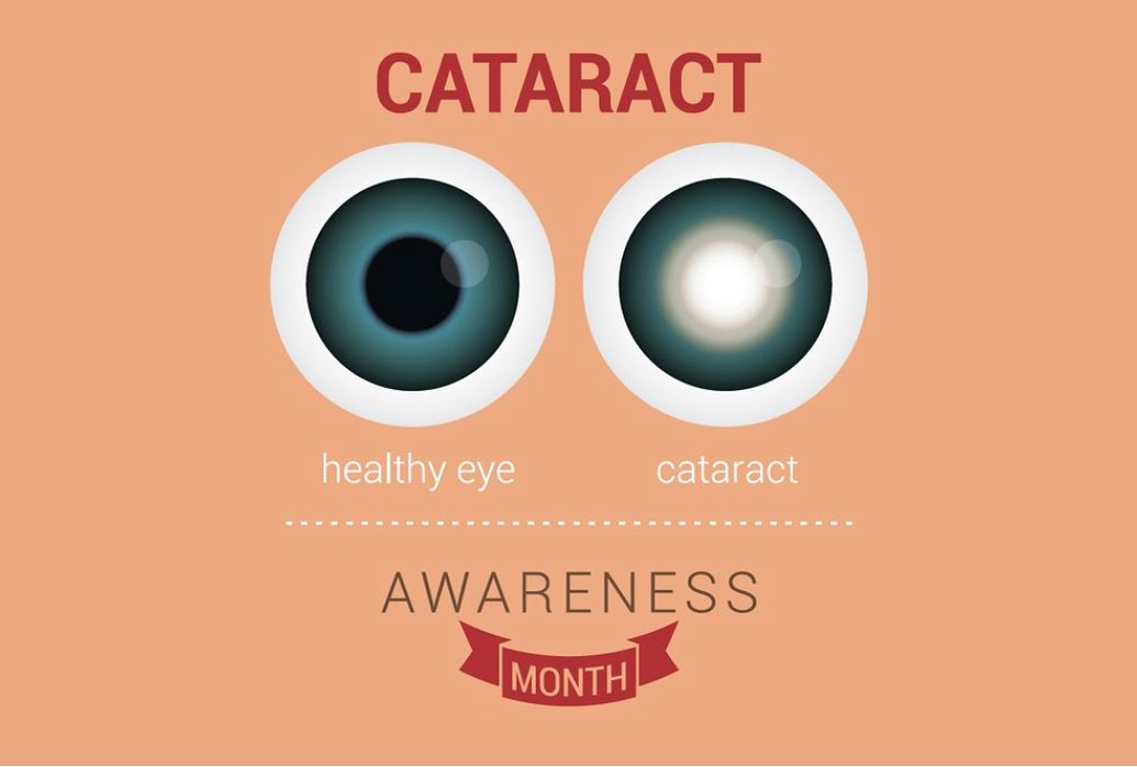 Advanced - June is Cataract Awareness month! Did you know that ...