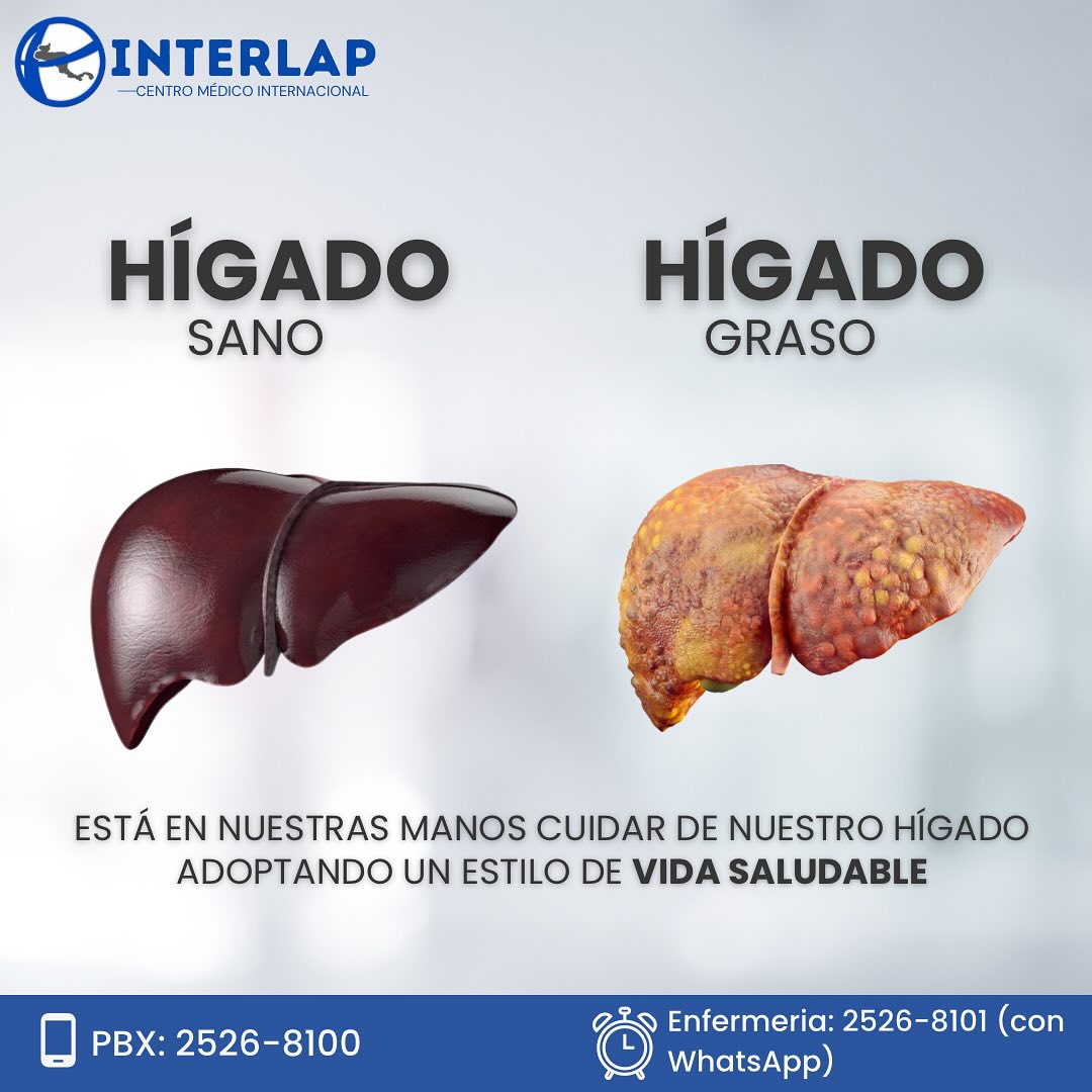 🌟 ¡Cuida tu... - Interlap - Centro Médico Internacional | Facebook