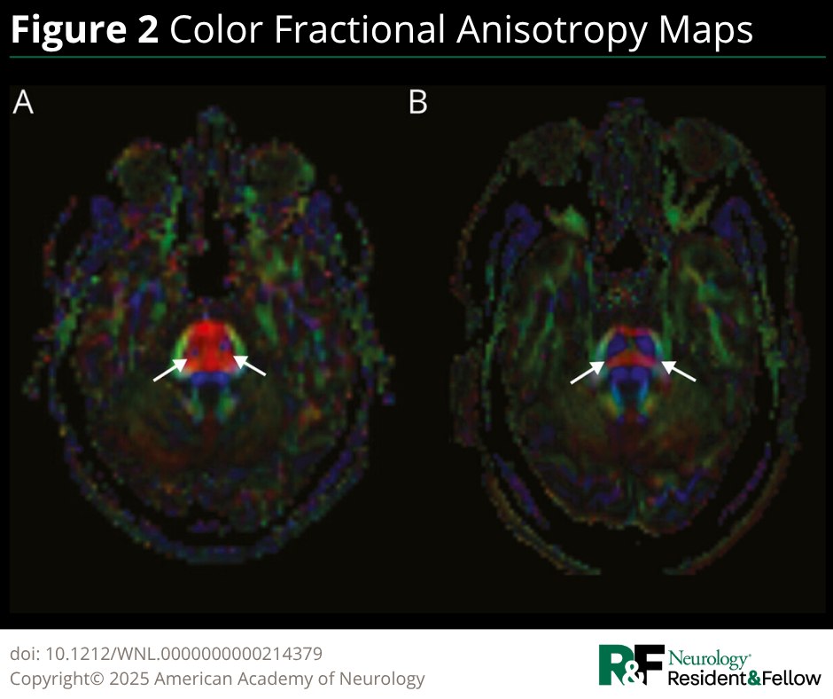 Clini... - American Academy of Neurology Residents and Fellows | Facebook