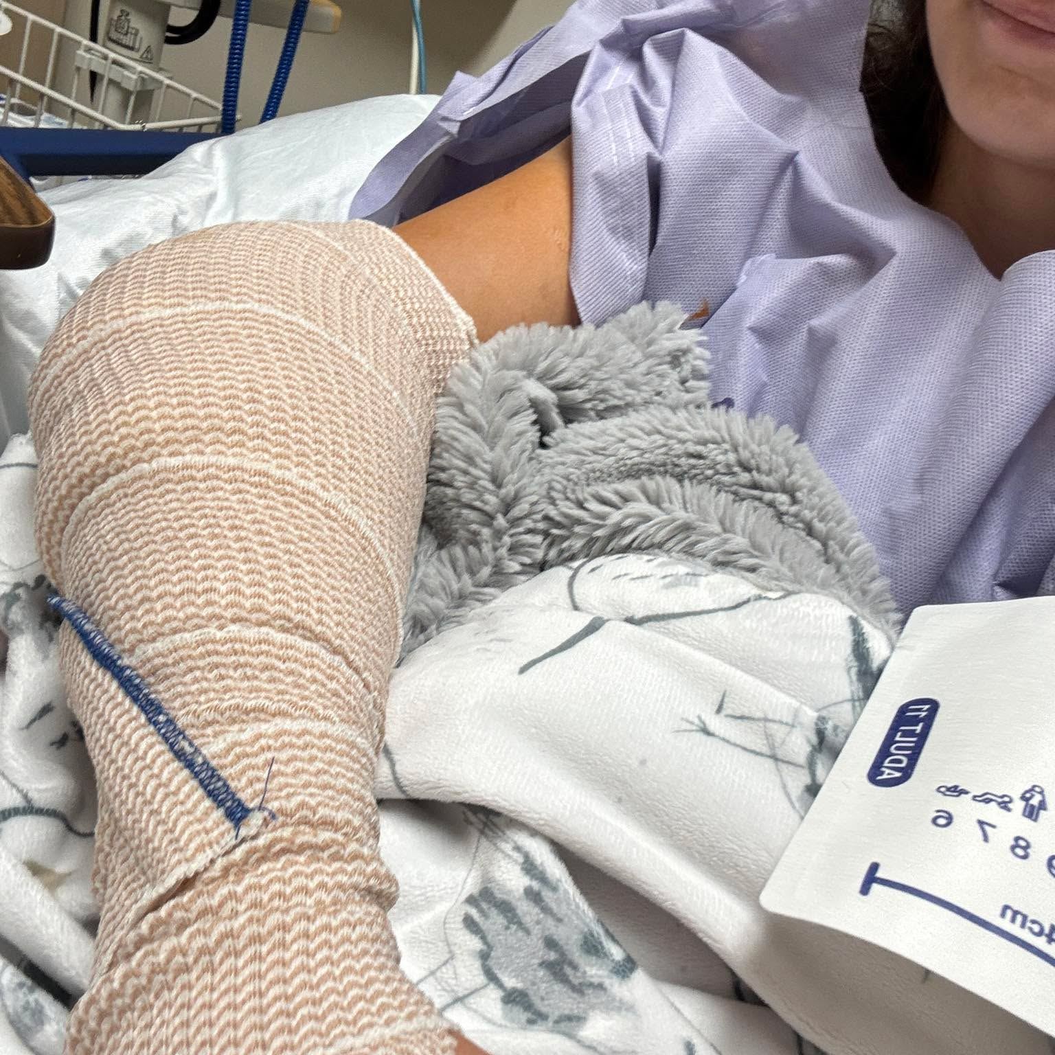 The Mellor - Cheyenne had surgery today on her arm. She had a pretty ...