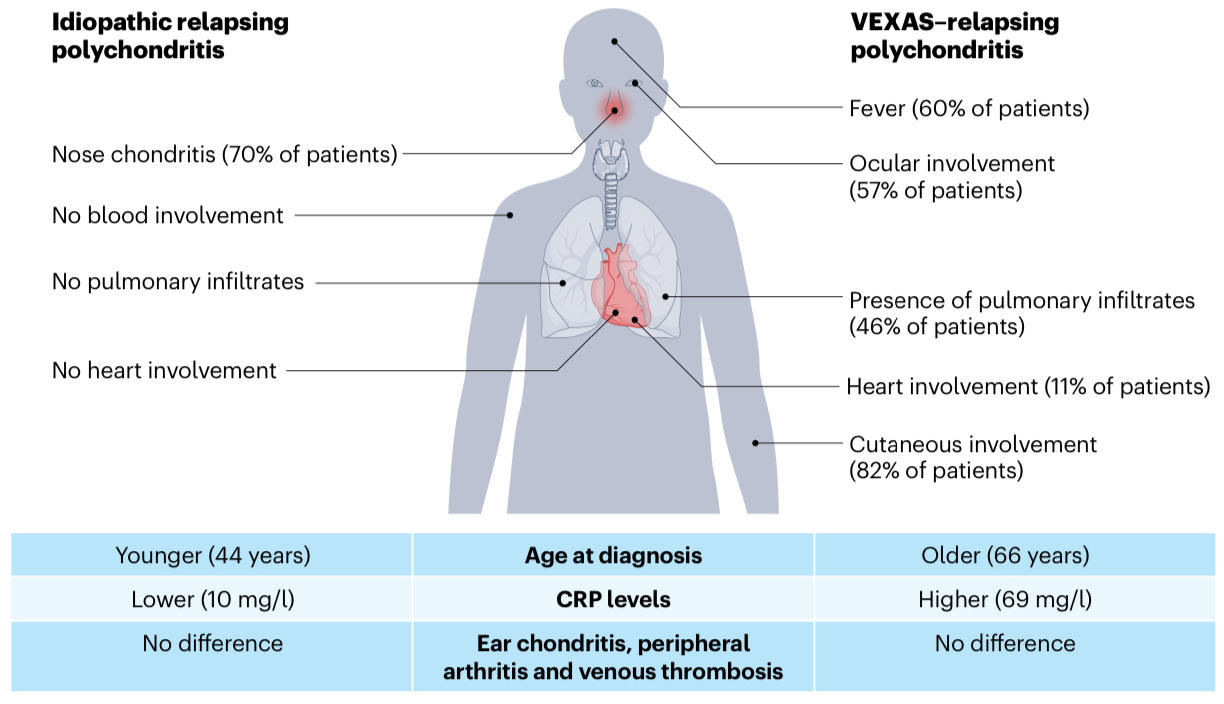 MedClub - #Reumatología #MedicinaInterna Principales diferencias entre ...