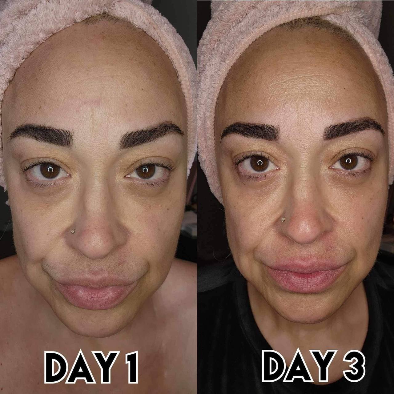 ✨ Glow daily with FERN-C Beauty Glutathione + Vit C #WatsonsPH #FERNCBeauty