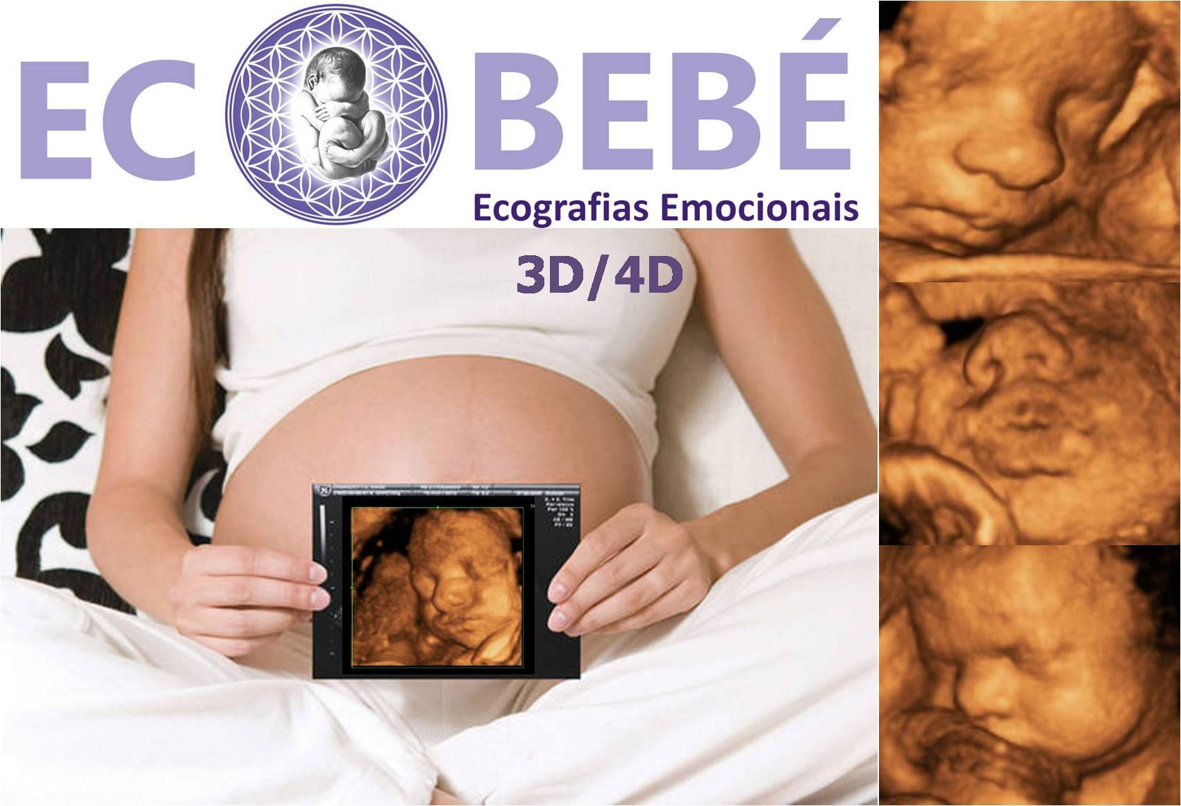 Eco Bebe Ecografias Emocionales 3d 4d En Ourense Photos Facebook
