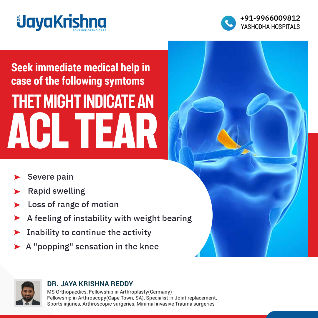 Dr.Jaya Krishna Reddy T - An ACL injury is a tear or sprain of the ...