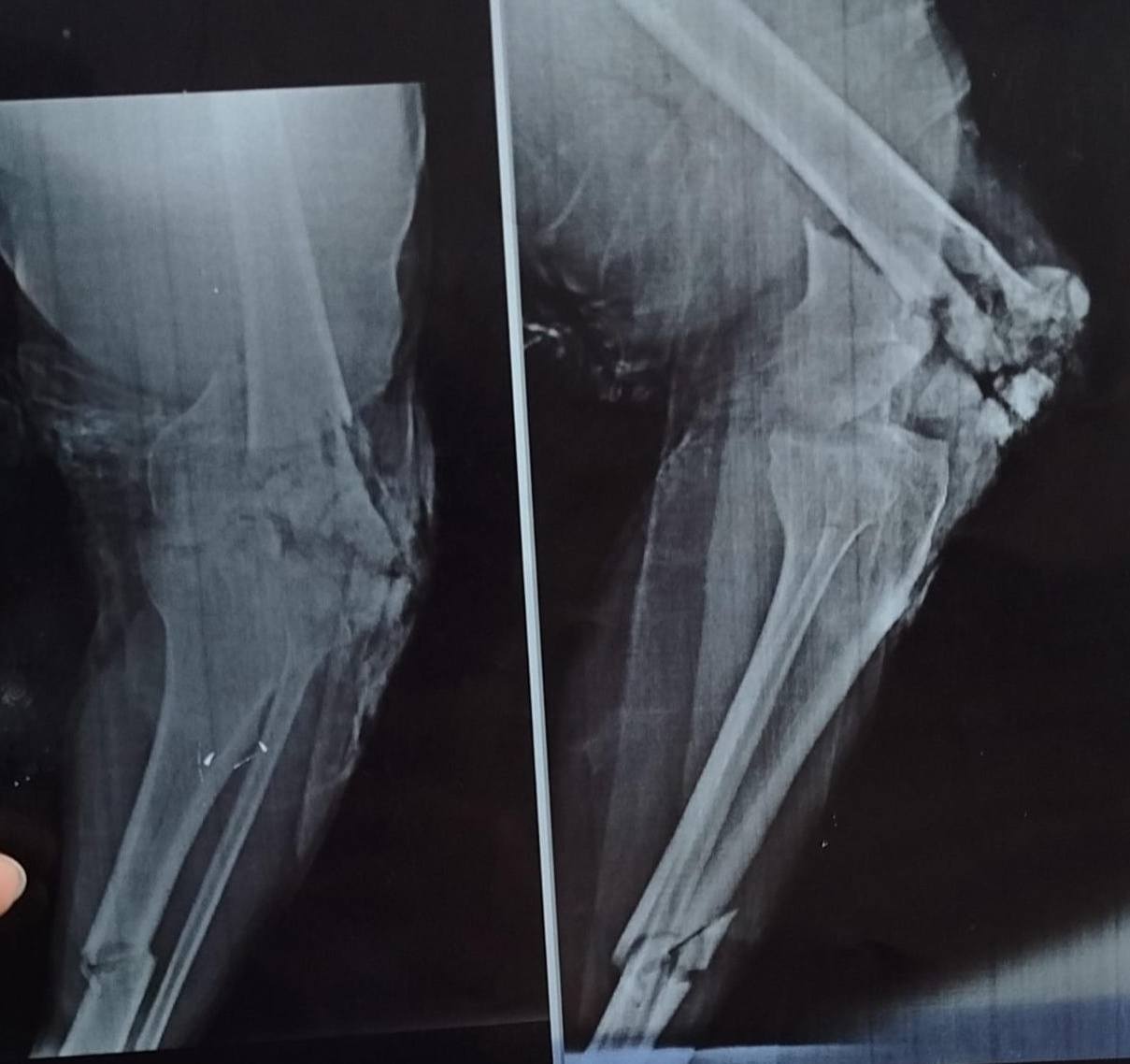 Department of Orthopaedic Surgery, Mayo Hospital, Lahore | Facebook